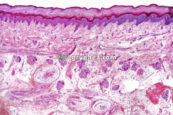 Peau CT Pacini x5 - gryphea.org